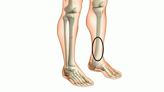 Tình trạng đau nhức xương ống chân