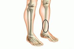 Hướng dẫn cách khắc phục tình trạng xương chân đau nhức