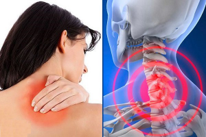 Giải pháp điều trị và phòng ngừa tình trạng đau vai gáy
