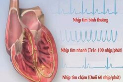 Nhịp tim của người bình thường là bao nhiêu?