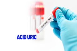 Tăng acid uric máu: Nguyên nhân, triệu chứng và cách điều trị