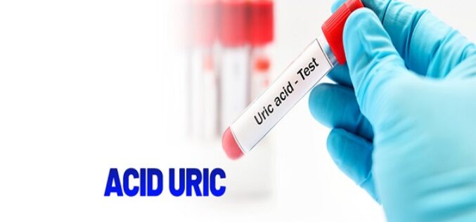 Tăng acid uric máu: Nguyên nhân, triệu chứng và cách điều trị