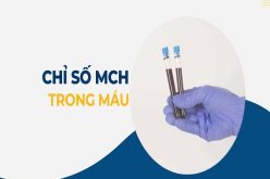 Chỉ số MCH trong xét nghiệm máu là gì?